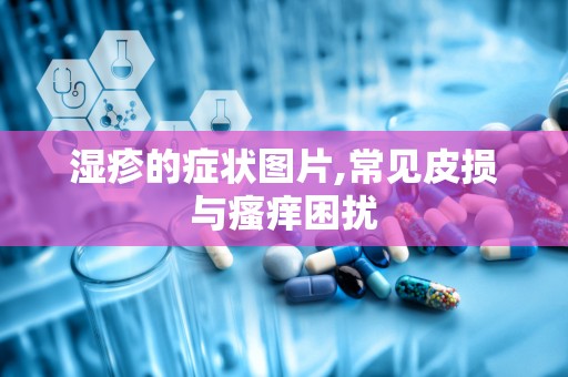 湿疹的症状图片,常见皮损与瘙痒困扰