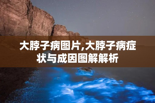 大脖子病图片,大脖子病症状与成因图解解析