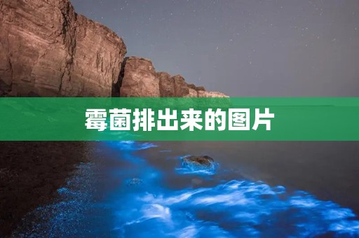 霉菌排出来的图片