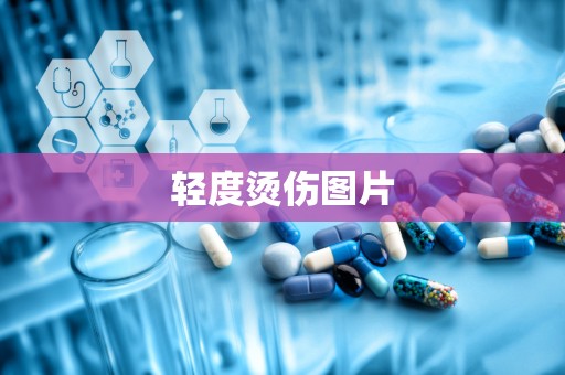 轻度烫伤图片