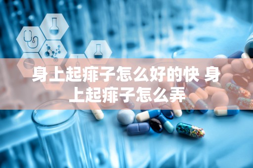 身上起痱子怎么好的快 身上起痱子怎么弄