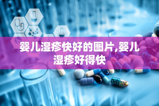 婴儿湿疹快好的图片,婴儿湿疹好得快
