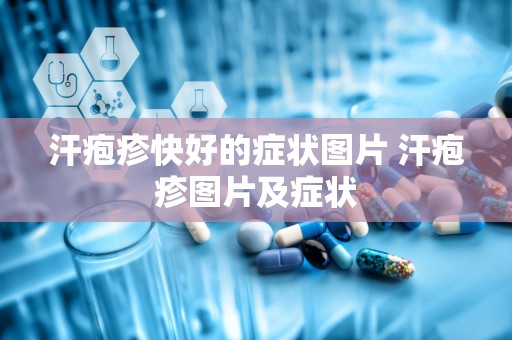 汗疱疹快好的症状图片 汗疱疹图片及症状