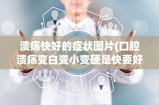 溃疡快好的症状图片(口腔溃疡变白变小变硬是快要好了吗)