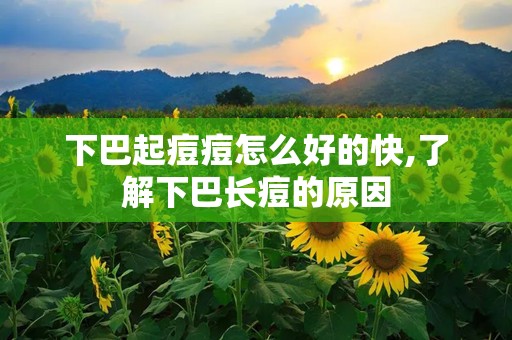 下巴起痘痘怎么好的快,了解下巴长痘的原因