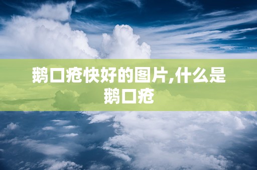 鹅口疮快好的图片,什么是鹅口疮